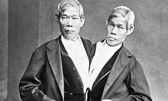 Chang and Eng -- Siamese Twins